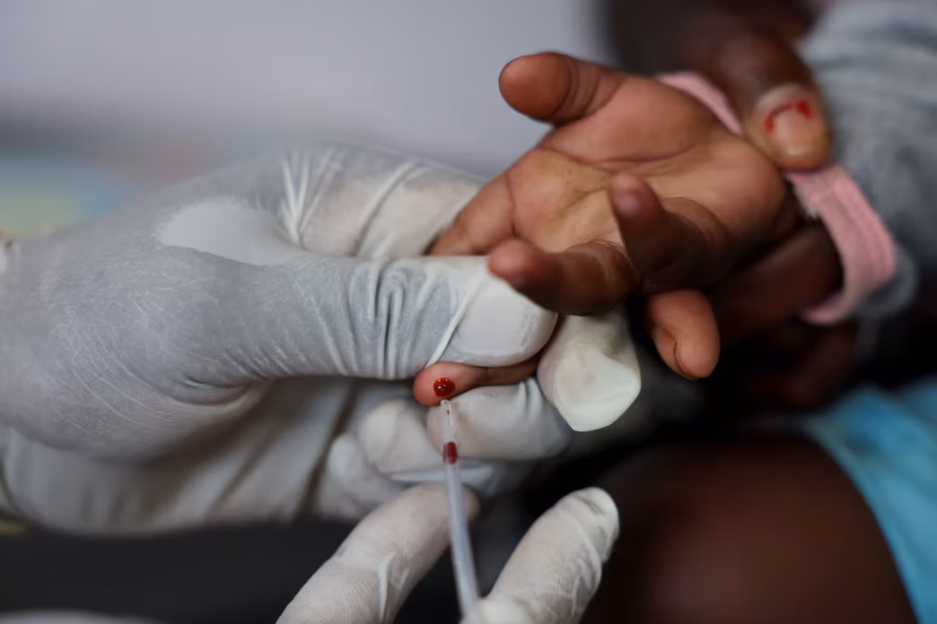 HIV (News Central TV)