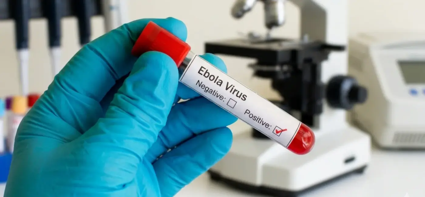 DR Congo's Locals Link Ebola to Witchcraft (News Central TV)