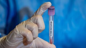 Hantavirus (News Central TV)