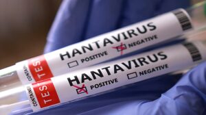New Suspected Hantavirus Cases Found in Spain, Tristan da Cunha (NewsCentral TV)