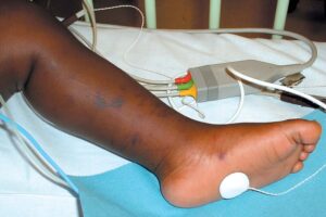 34 Die in Sokoto Meningitis Outbreak (News Central TV)