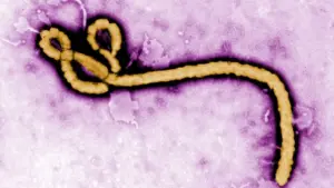 Why Ebola Outbreak in Africa Draws Global Attention