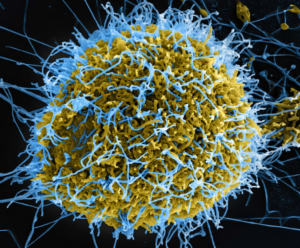 Africa CDC Declares Ebola Continental Emergency (News Central TV)